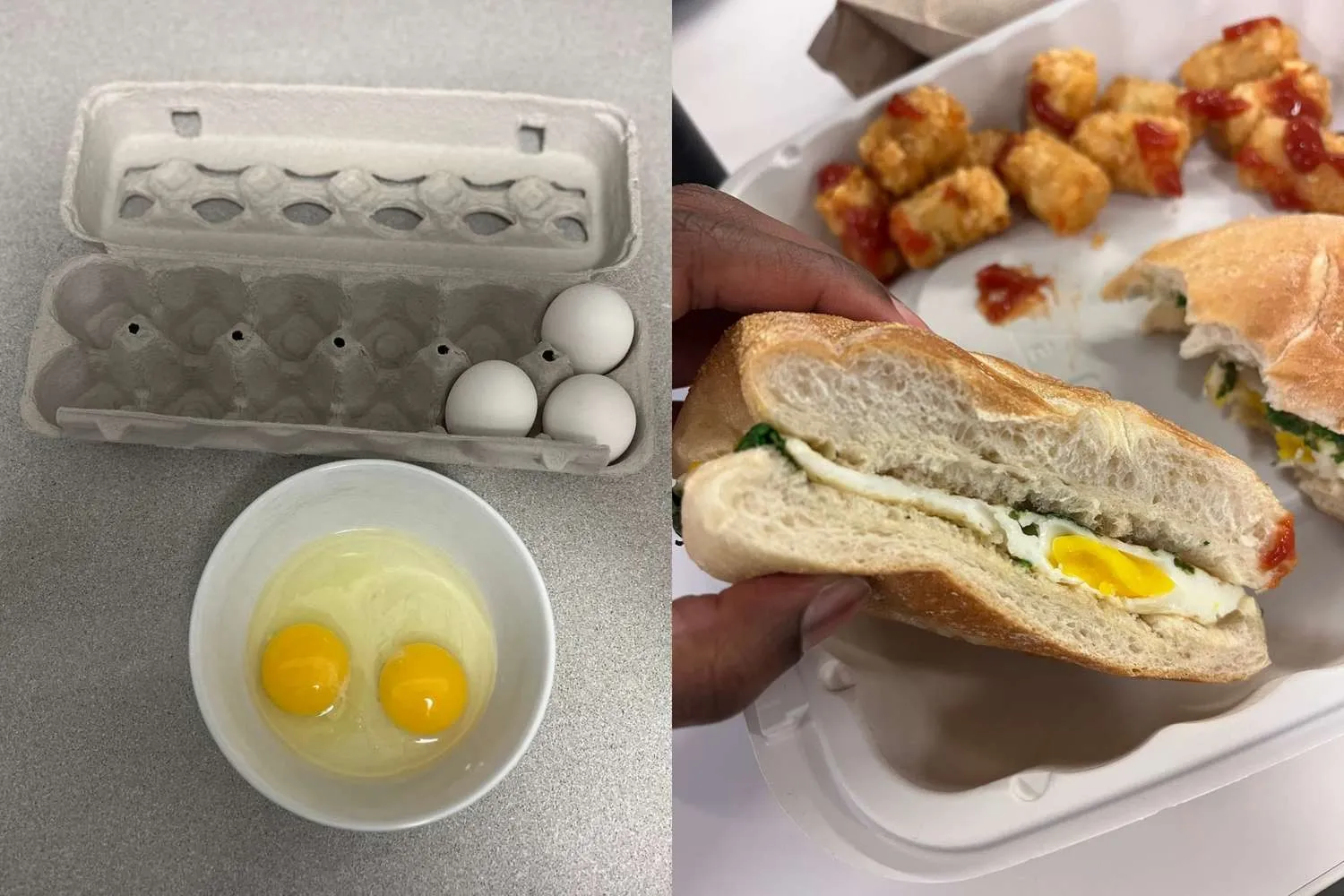 Eggs Should You Eat Daily