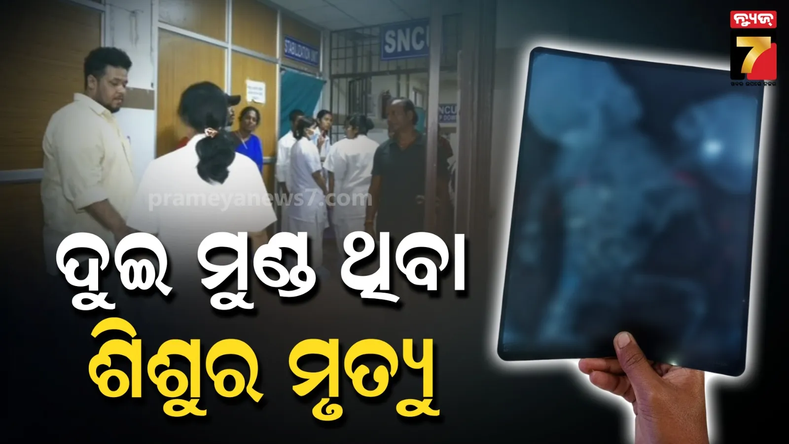 ଜନ୍ମରୁ ଗୁରୁତର ଥିଲା ସ୍ୱାସ୍ଥ୍ୟାବସ୍ଥା, ଏମ୍‌କେସିଜିରେ ଦୁଇଟି ମୁଣ୍ଡ ଥିବା ଶିଶୁର ମୃତ୍ୟୁ