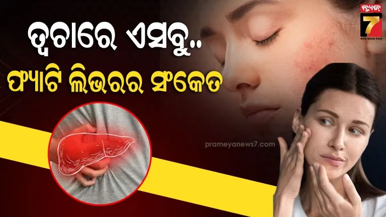 adar-poonawalla-on-lt-chairmans-remark