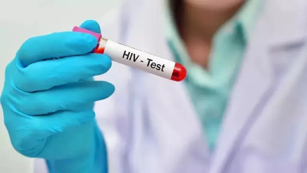 HIV