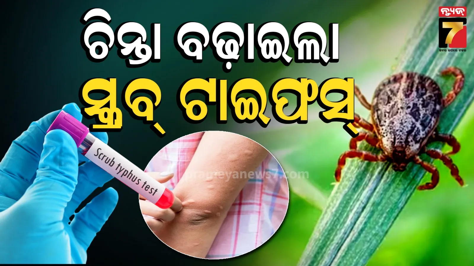 Scrub typhus cases: ସୁନ୍ଦରଗଡ଼ରେ ସ୍କ୍ରବ୍ ଟାଇଫସ୍ ଟେନସନ୍, ୯୦୦ ପାର୍ କଲା ଆକ୍ରାନ୍ତଙ୍କ ସଂଖ୍ୟା