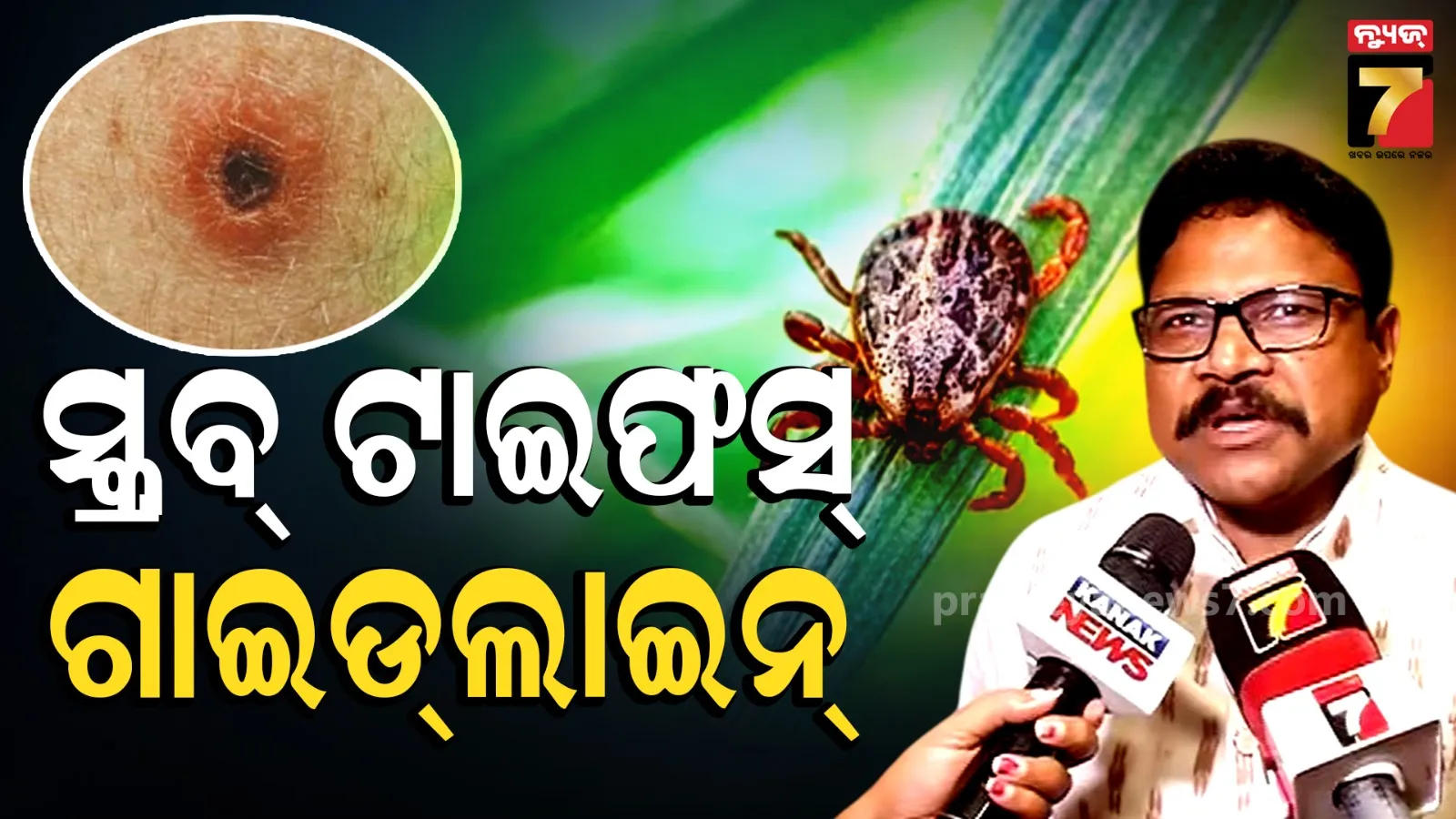 Scrub Typhus: ସ୍କ୍ରବ୍ ଟାଇଫସ୍ ନିୟନ୍ତ୍ରଣ ପାଇଁ ତତ୍ପର ସ୍ୱାସ୍ଥ୍ୟ ବିଭାଗ, ଚିହ୍ନଟ ଅଞ୍ଚଳକୁ ଯିବେ ଡାକ୍ତରୀ ଟିମ୍